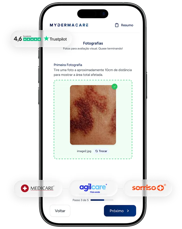 Aplicação MyDermaCare — relatório médico e plano de tratamento
