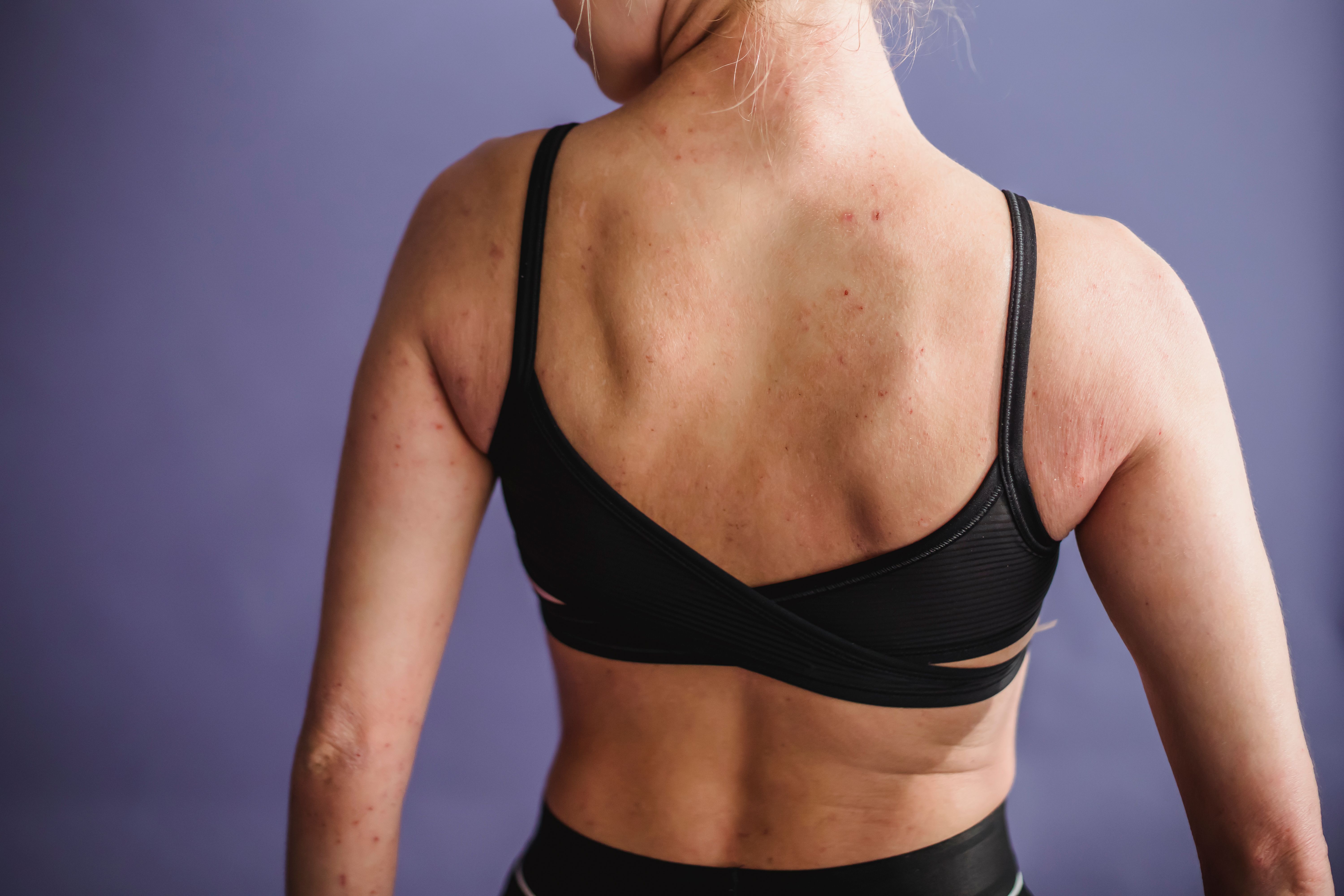 Consulta de Dermatologia Urgente online